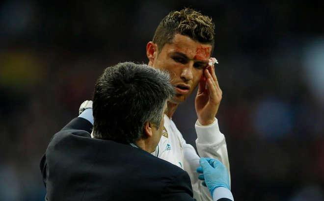 Ronaldo đổ máu tìm lại niềm kiêu hãnh, Real thắng hơn cả một set tennis
