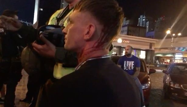 NÓNG: CĐV Liverpool bị tấn công chảy máu đầu tại Kiev