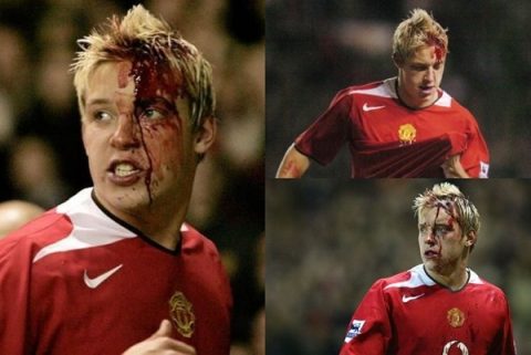 13 chấn thương kinh hoàng nhất lịch sử bóng đá: Phải chăng thảm họa này khiến Torres sa sút đến như vậy